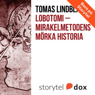 Lobotomi - Mirakelmetodens mörka historia