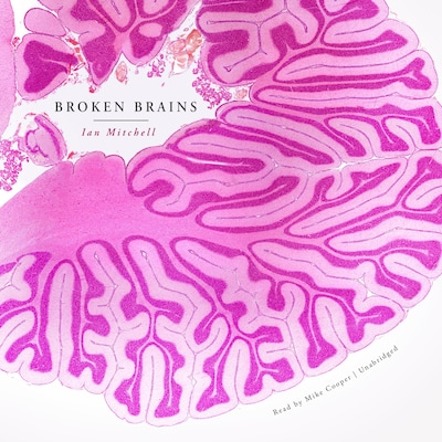 Broken Brains – omslag til lydbogen af Ian Mitchell