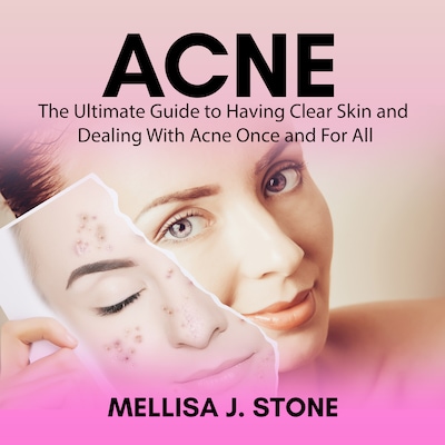 Acne: The Ultimate Guide to Having Clear Skin and Dealing With Acne Once and For All – omslag til lydbogen af Mellisa J. Stone