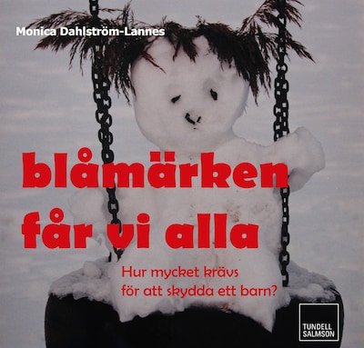 Blåmärken får vi alla