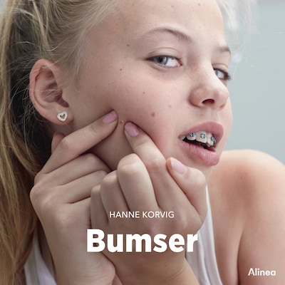 Bumser – omslag til lydbogen af Hanne Korvig